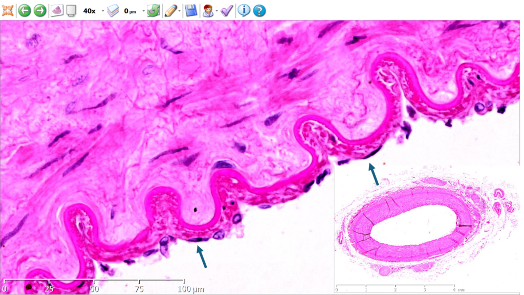 Corte transversal de arteria muscular. Tincion H:E